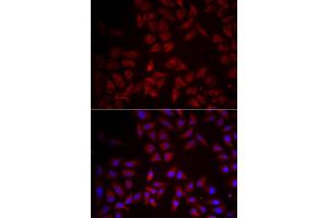 Immunofluorescence analysis of HeLa cells using CCL25 antibody. (CCL25 抗体)