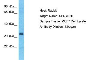 Host: Rabbit Target Name: SPDYE2B Sample Type: MCF7 Whole Cell lysates Antibody Dilution: 1. (SPDYE2B 抗体  (C-Term))