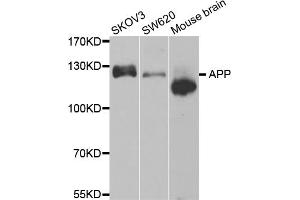 Western blot analysis of extracts of various cell lines, using APP antibody (ABIN5971616). (APP 抗体)