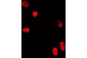 Immunofluorescent analysis of WDR5 staining in U2OS cells. (WDR5 抗体)