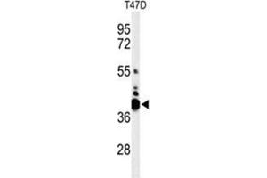 Western blot analysis of VTCN1 Antibody (Center) in T47D cell line lysates (35 µg/lane).