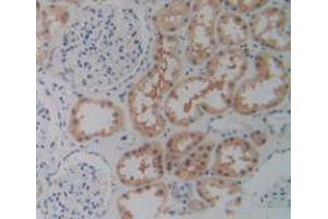IHC-P analysis of Human Kidney Tissue, with DAB staining. (P2RX7 抗体  (AA 47-334))