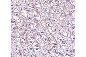 Immunohistochemistry of TSLP-R in human liver tissue with this product at 5 μg/ml. (CRLF2 抗体  (Center))