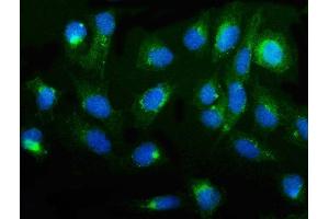 IF analysis of CGKI/PRKG1 using anti-CGKI/PRKG1 antibody (ABIN7600502).