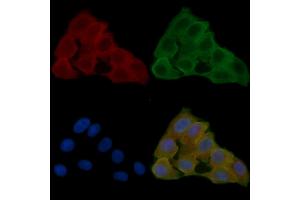 ABIN6261665 and ABIN6278570 staining Hela cells(24h of starvation treatment) by IF/ICC. (FASTKD2 抗体  (Internal Region))