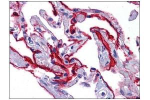 Human Lung: Formalin-Fixed, Paraffin-Embedded (FFPE) (SCUBE2 抗体)