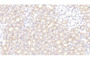 Detection of SNCa in Rat Kidney Tissue using Polyclonal Antibody to Synuclein Alpha (SNCa) (SNCA 抗体  (AA 23-140))