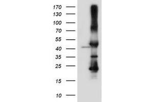 Western Blotting (WB) image for anti-serpin Peptidase Inhibitor, Clade B (Ovalbumin), Member 6 (SERPINB6) antibody (ABIN1500892) (SERPINB6 抗体)