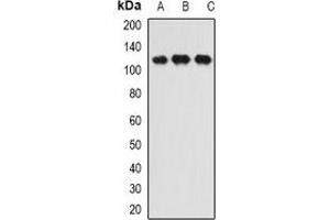 Western blot analysis of INTS6 expression in HL60 (A), SW620 (B), Hela (C) whole cell lysates. (INTS6 抗体)
