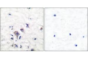 Immunohistochemistry analysis of paraffin-embedded human brain tissue, using mGluR2/3 Antibody. (mGluR2/3 抗体  (AA 823-872))