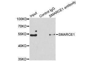 Immunoprecipitation analysis of 150ug extracts of Jurkat cells using 3ug SMARCE1 antibody.