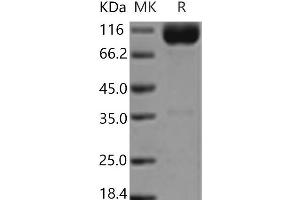Western Blotting (WB) image for Interleukin 18 Receptor 1 (IL18R1) protein (Fc Tag) (ABIN7321199)