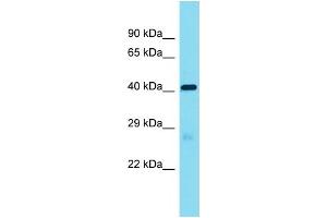 Host:  Rabbit  Target Name:  Lrrc19  Sample Type:  Mouse Heart lysates  Antibody Dilution:  1. (LRRC19 抗体  (Middle Region))