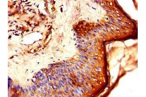 Immunohistochemistry of paraffin-embedded human skin tissue using ABIN7157921 at dilution of 1:100