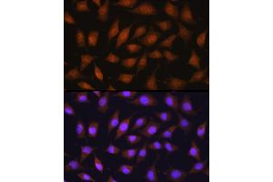 Immunofluorescence (IF) image for anti-Ribosomal Protein SA (RPSA) (AA 1-295) antibody (ABIN6147247)