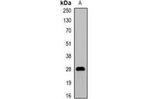 Western blot analysis of ProDynorphin expression in Hela (A) whole cell lysates. (PDYN 抗体)