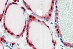 ABIN302136 (2. (FZD2 抗体  (Internal Region))