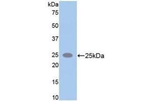 Detection of Recombinant SPTAN1, Rat using Polyclonal Antibody to Alpha-Fodrin (SPTAN1) (SPTAN1 抗体  (AA 2071-2269))