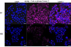 Immunocytochemical staining of HeLa cells using Acetyl-CoA acyltransferase 2 antibody (ABIN7797441), 1:1,000), Top panel: wild-type (WT), Bottom panal: Acetyl-CoA acyltransferase 2 shRNA knockdown (KD). (Recombinant ACAA2 抗体)