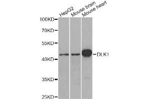 Western blot analysis of extracts of various cell lines, using DLK1 antibody. (DLK1 抗体)