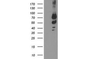 Western Blotting (WB) image for anti-Katanin P80 (WD Repeat Containing) Subunit B 1 (KATNB1) antibody (ABIN1498986) (KATNB1 抗体)