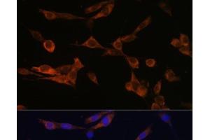 Immunofluorescence analysis of NIH-3T3 cells using YWHAH Polyclonal Antibody at dilution of 1:100 (40x lens). (14-3-3 eta 抗体)