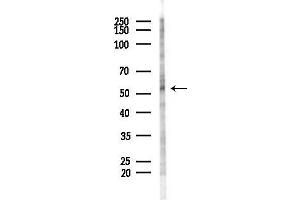 Western blot analysis of lysates from COLO205 cells(heat-shock,45 min treatment), using SHB Antibody at 1/1000 dilution.