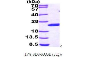SDS-PAGE (SDS) image for Sonic Hedgehog (SHH) (AA 24-197) protein (His tag) (ABIN667009) (Sonic Hedgehog Protein (SHH) (AA 24-197) (His tag))
