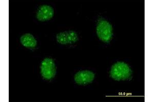 Immunofluorescence of purified MaxPab antibody to RBM41 on HeLa cell. (RBM41 抗体  (AA 1-413))