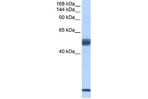 SF3B14 antibody used at 2 ug/ml to detect target protein. (Pre-mRNA Branch Site Protein p14 (SF3B14) (Middle Region) 抗体)