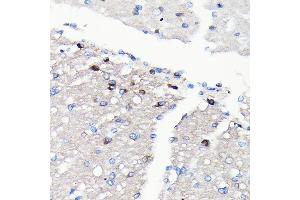 Immunohistochemistry of paraffin-embedded rat brain using NMDA Rabbit mAb (ABIN7267420) at dilution of 1:100 (40x lens). (NMDAR2A 抗体)