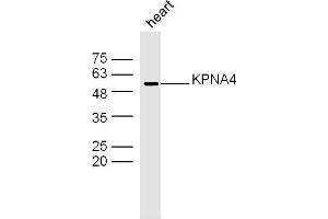 Mouse heart lysates probed with KPNA4 Polyclonal Antibody, Unconjugated  at 1:300 dilution and 4˚C overnight incubation. (KPNA4 抗体  (AA 1-100))
