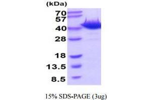 SDS-PAGE (SDS) image for 8-Oxoguanine DNA Glycosylase (OGG1) (AA 1-345) protein (His tag) (ABIN6388043) (OGG1 Protein (AA 1-345) (His tag))