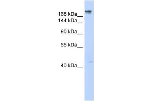WB Suggested Anti-DYSF Antibody Titration:  0. (Dysferlin 抗体  (Middle Region))