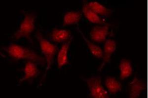 Immunofluorescence (fixed cells) (IF/ICC) image for anti-Receptor tyrosine-protein kinase erbB-2 (ErbB2/Her2) (pTyr1112) antibody (ABIN6255774)
