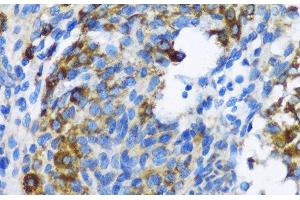 Immunohistochemistry of paraffin-embedded Rat ovary using PTCH1 Polyclonal Antibody at dilution of 1:100 (40x lens). (Patched 1 抗体)