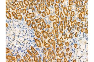 ABIN6259707 and ABIN6276744 at 1/100 staining Rat kidney tissue by IHC-P. (ABO 抗体  (N-Term))