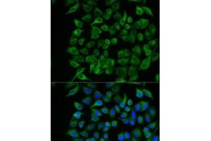 Immunofluorescence analysis of U2OS cells using PAEP Polyclonal Antibody (PAEP 抗体)