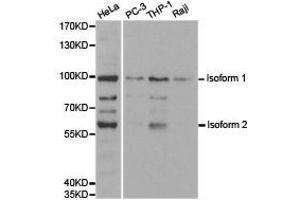 Western Blotting (WB) image for anti-Ubiquitin-Like with PHD and Ring Finger Domains 2, E3 Ubiquitin Protein Ligase (UHRF2) antibody (ABIN1875279) (UHRF2 抗体)