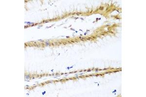 Immunohistochemistry of paraffin-embedded human stomach using UNG antibody at dilution of 1:100 (40x lens). (UNG 抗体)
