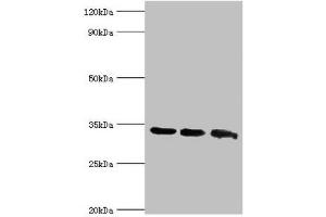 Western blot All lanes: Aquaporin-4 antibody at 2 μg/mL Lane 1: Mouse brain tissue Lane 2: Mouse heart tissue Lane 3: Mouse kidney tissue Secondary Goat polyclonal to rabbit IgG at 1/10000 dilution Predicted band size: 35, 33 kDa Observed band size: 35 kDa (Aquaporin 4 抗体  (AA 244-323))