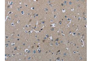 The image on the left is immunohistochemistry of paraffin-embedded Human brain tissue using ABIN7129423(FAAH Antibody) at dilution 1/50, on the right is treated with fusion protein. (FAAH 抗体)