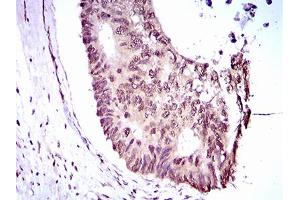 Immunohistochemistry (IHC) image for anti-Kruppel-Like Factor 1 (erythroid) (KLF1) (AA 208-362) antibody (ABIN1724828)