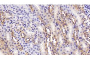 Detection of CASR in Mouse Kidney Tissue using Polyclonal Antibody to Calcium Sensing Receptor (CASR) (CASR 抗体  (AA 863-1079))