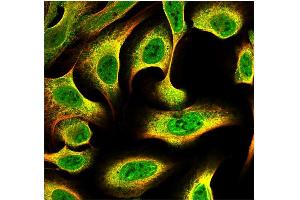 This antibody stained U-2 OS and U-251 MG cells. (IGFBP5 抗体)
