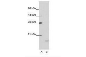 Image no. 1 for anti-Interferon Stimulated Exonuclease Gene 20kDa (ISG20) (AA 35-84) antibody (ABIN202043) (ISG20 抗体  (AA 35-84))