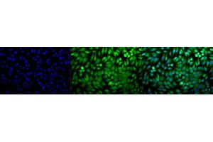 Immunocytochemistry/Immunofluorescence analysis using Rabbit Anti-p38 Polyclonal Antibody (ABIN361847 and ABIN361848). (MAPK14 抗体)