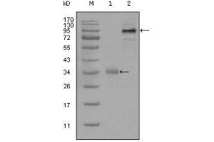 Western blot analysis using ETV1 mouse mAb against truncated Trx-ETV1 recombinant protein (1) and full-length ETV1 (aa1-477)-hIgGFc transfected CHO-K1 cell lysate(2). (ETV1 抗体  (AA 1-191))