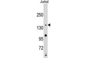 Western Blotting (WB) image for anti-Structural Maintenance of Chromosomes 2 (SMC2) antibody (ABIN2995231) (SMC2 抗体)