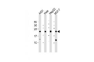All lanes : Anti-LITAF Antibody (N-Term) at 1:1000 dilution Lane 1: A431 whole cell lysate Lane 2: Hela whole cell lysate Lane 3: HepG2 whole cell lysate Lane 4: MCF-7 whole cell lysate Lysates/proteins at 20 μg per lane. (LITAF 抗体  (AA 31-60))